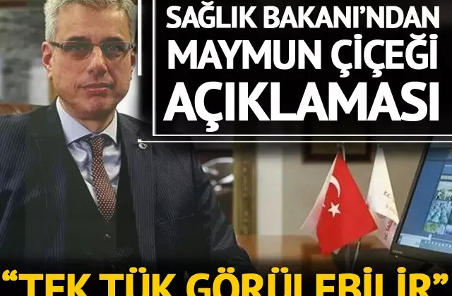 ‘Maymun Çiçeği’ salgını ile ilgili Sağlık Bakanı Memişoğlu’ndan yeni açıklama